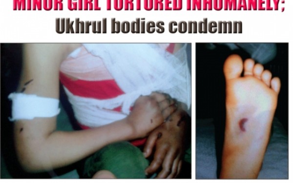 Minor girl tortured inhumanely