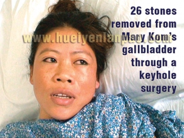 Mary Kom operated, stones removed from gallbladder