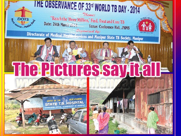 33rd World TB Day 2014