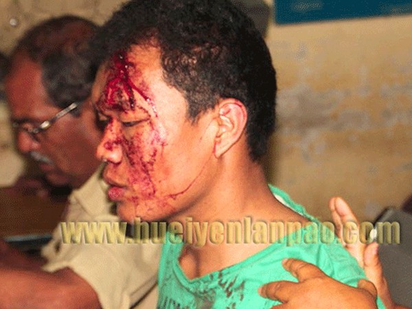 3 Manipuri youths assaulted for not speaking Kannada
