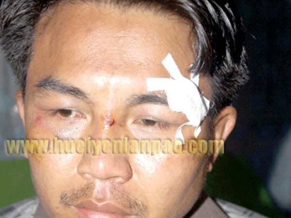 NSUC president brutally assaulted by MLA's son