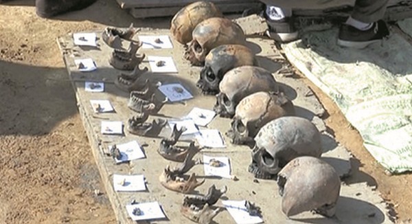 Skulls and skeletons discovered from the campus of now shut down Tombisana High School 