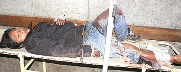 An injured cadre at RIMS 