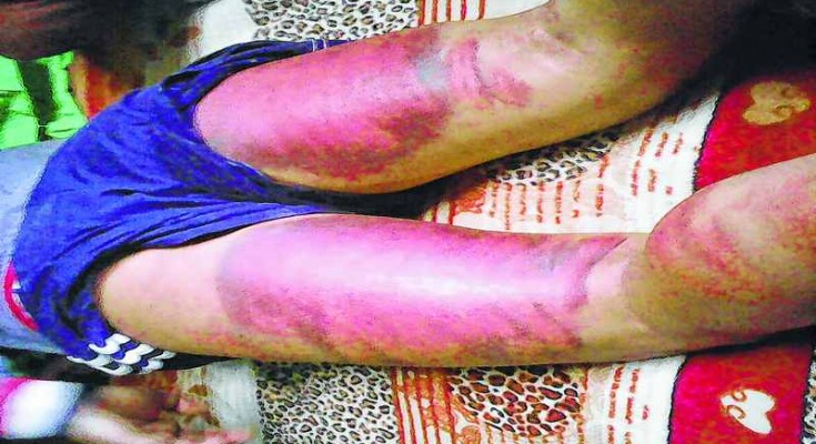 Ukhrul PDS agent assaulted
