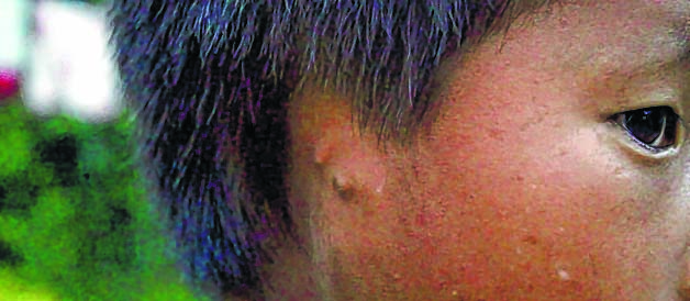 Born with undeveloped ear, child awaits miracle
