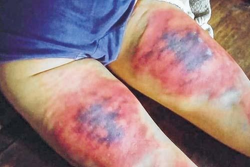 Youth severely assaulted over Travel Pass