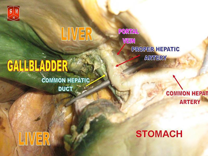 Gallbladder and hepatic artery
