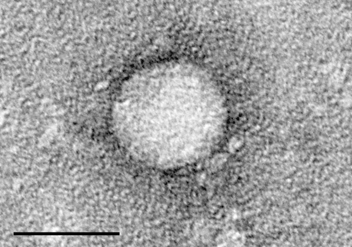 Electron micrographs of hepatitis C virus purified from cell culture. Scale bar is 50 nanometers
