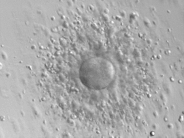Human oocyte with surrounding granulosa cells, after aspiration