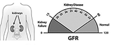 GFR glomerular filtration rate