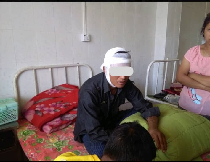  Civil Servant from Matupi Hospitalized After Attack by Tatmadaw Troops 