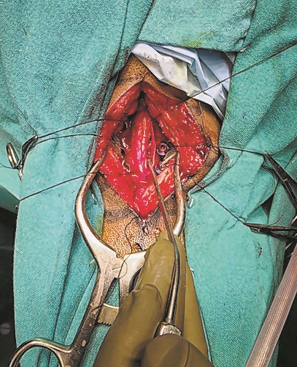 Doctor of Little Clinic saves two from paralysis