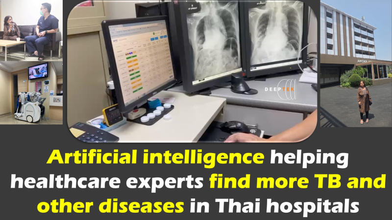  Artificial intelligence helping healthcare experts find more TB and other diseases in Thai hospitals